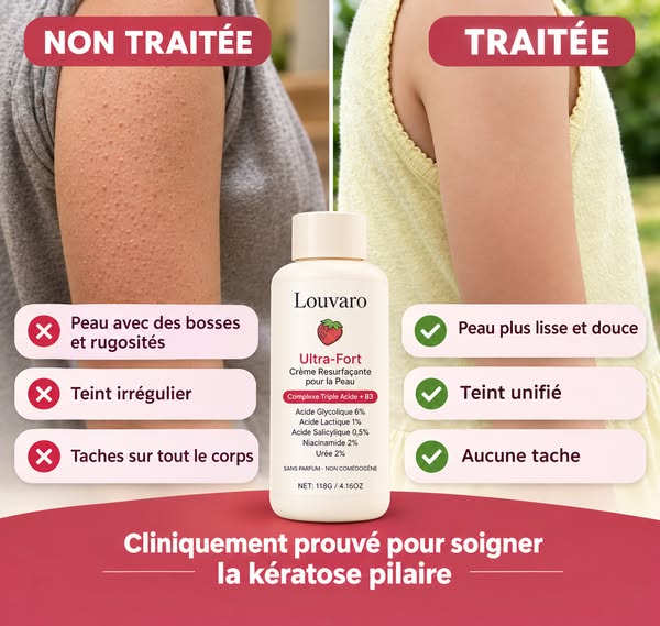 1 Acheté + 1 Offert
