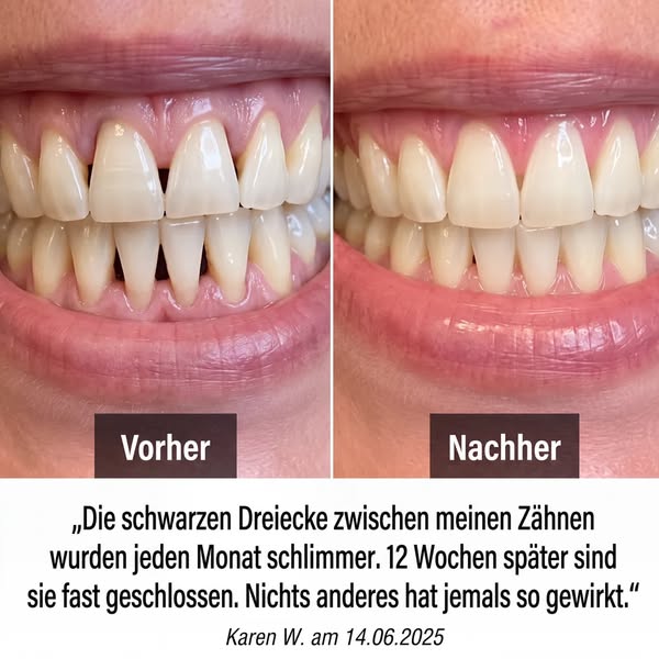 Wenn dein Zahnfleisch zurückgeht, solltest du das hier lesen