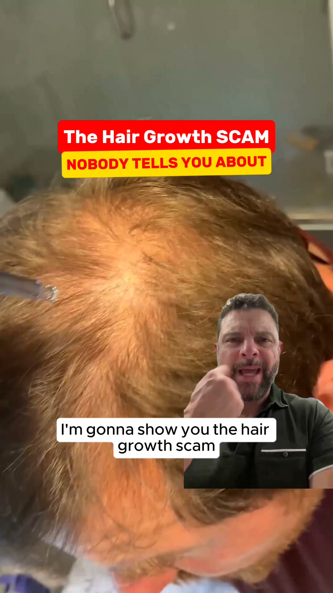 Less Scalp Showing Starts Here