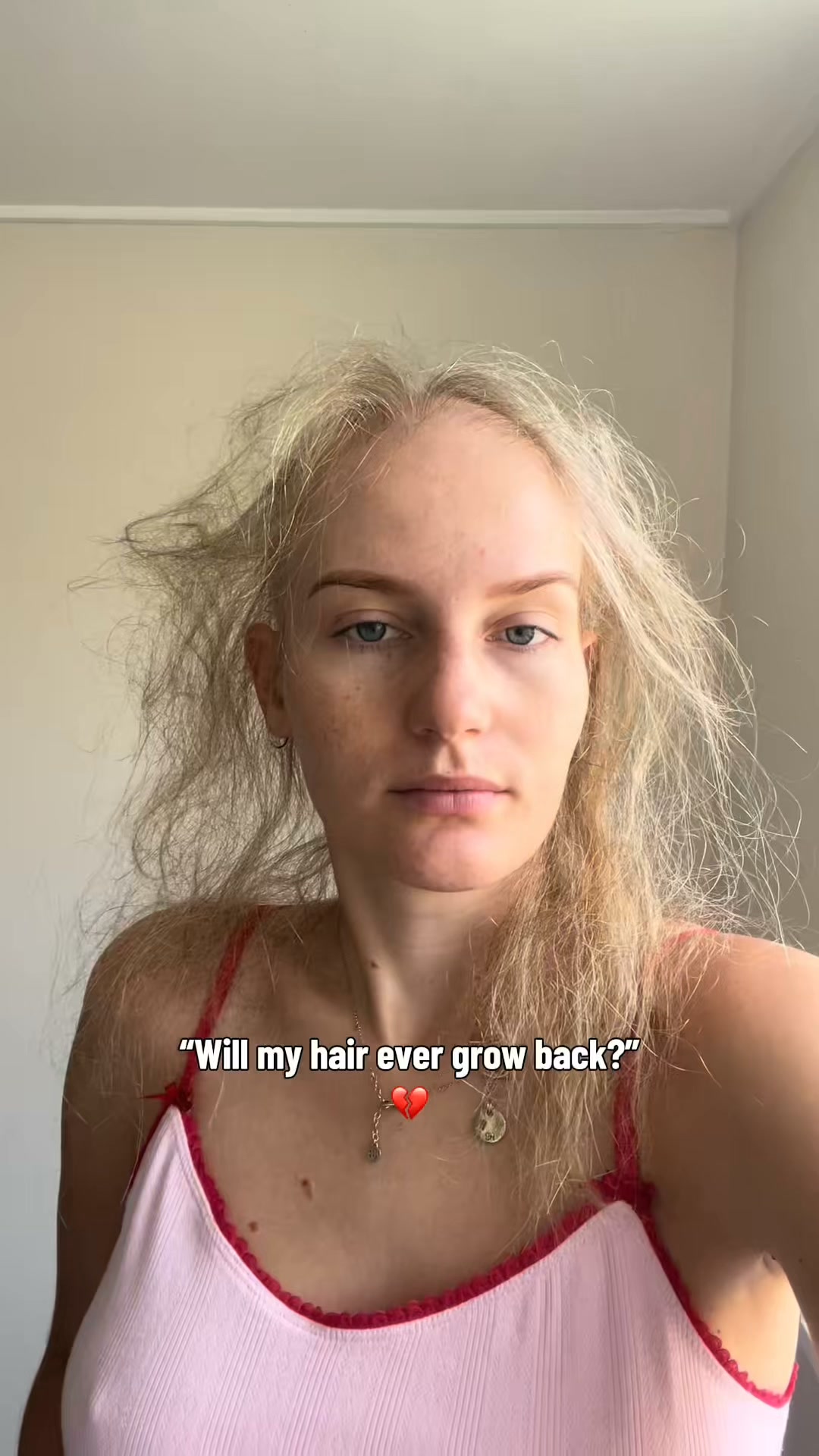 Korea's #1 Hair Growth Serum