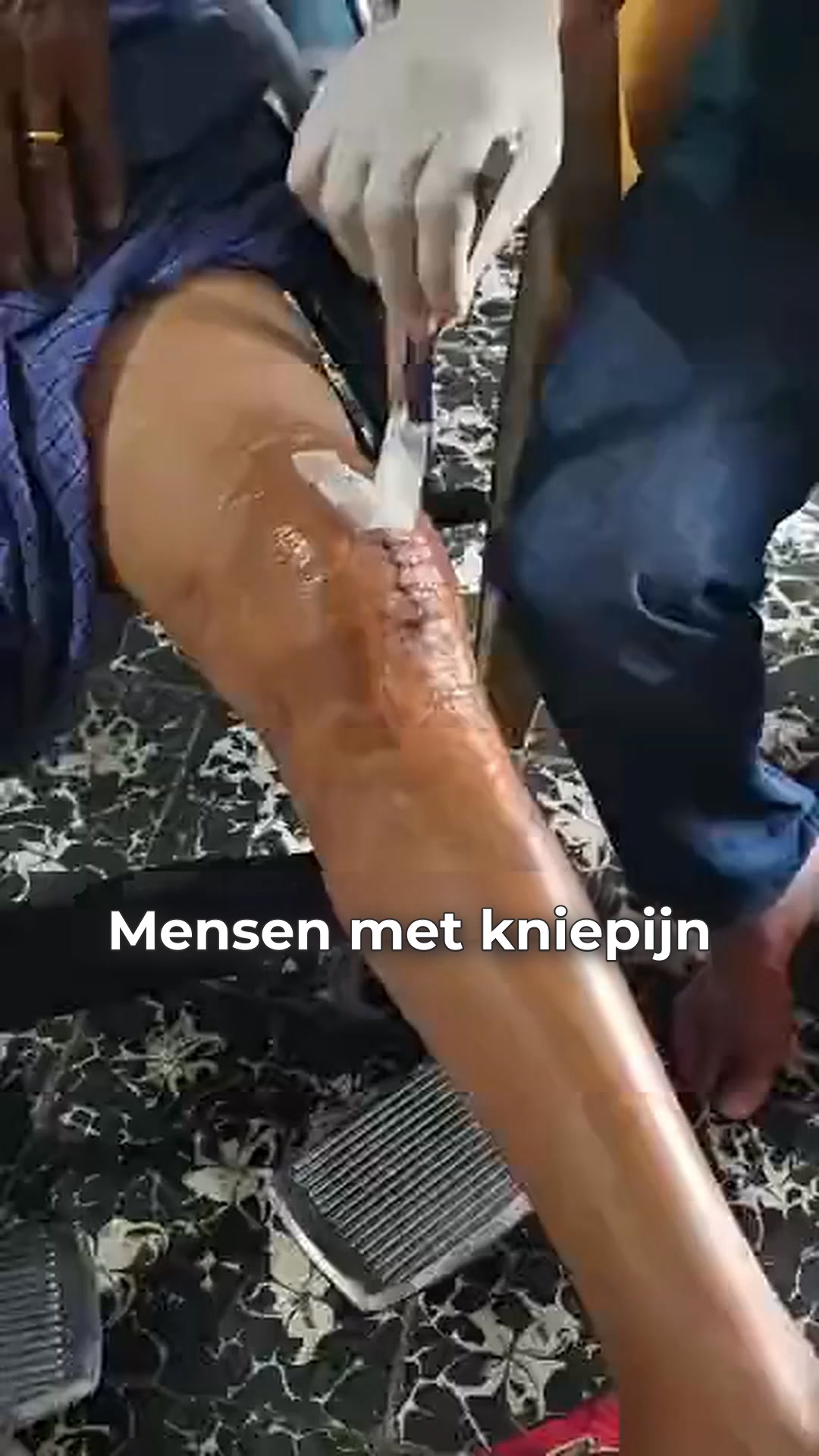 Kniepijn of artrose?