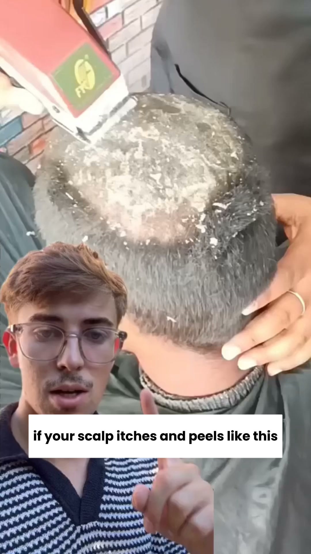 Anti-Dandruff Balancing Serum