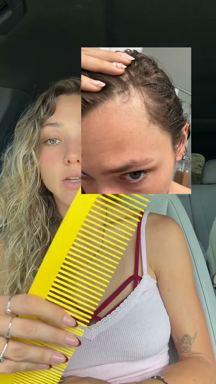 Fresher Scalp in Minutes