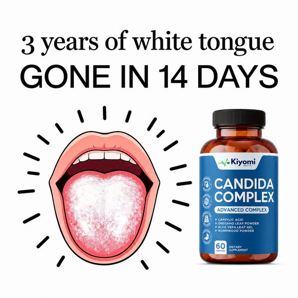 White Tongue Keeps Coming Back?