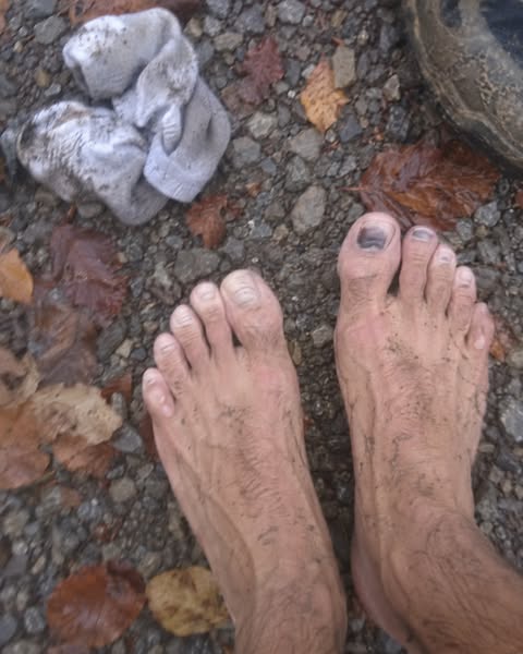 Un ongle noir n'est pas un trophée.