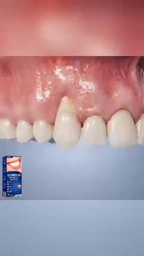 Focused Nighttime Care for the Gumline