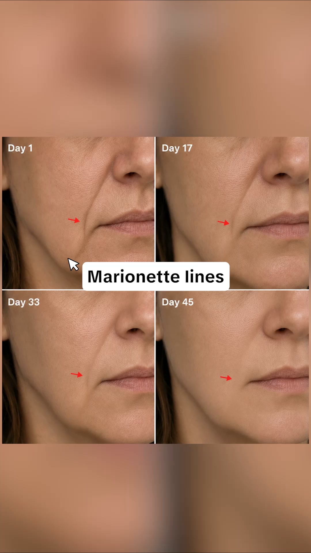 Skin doesn't have to surrender to gravity