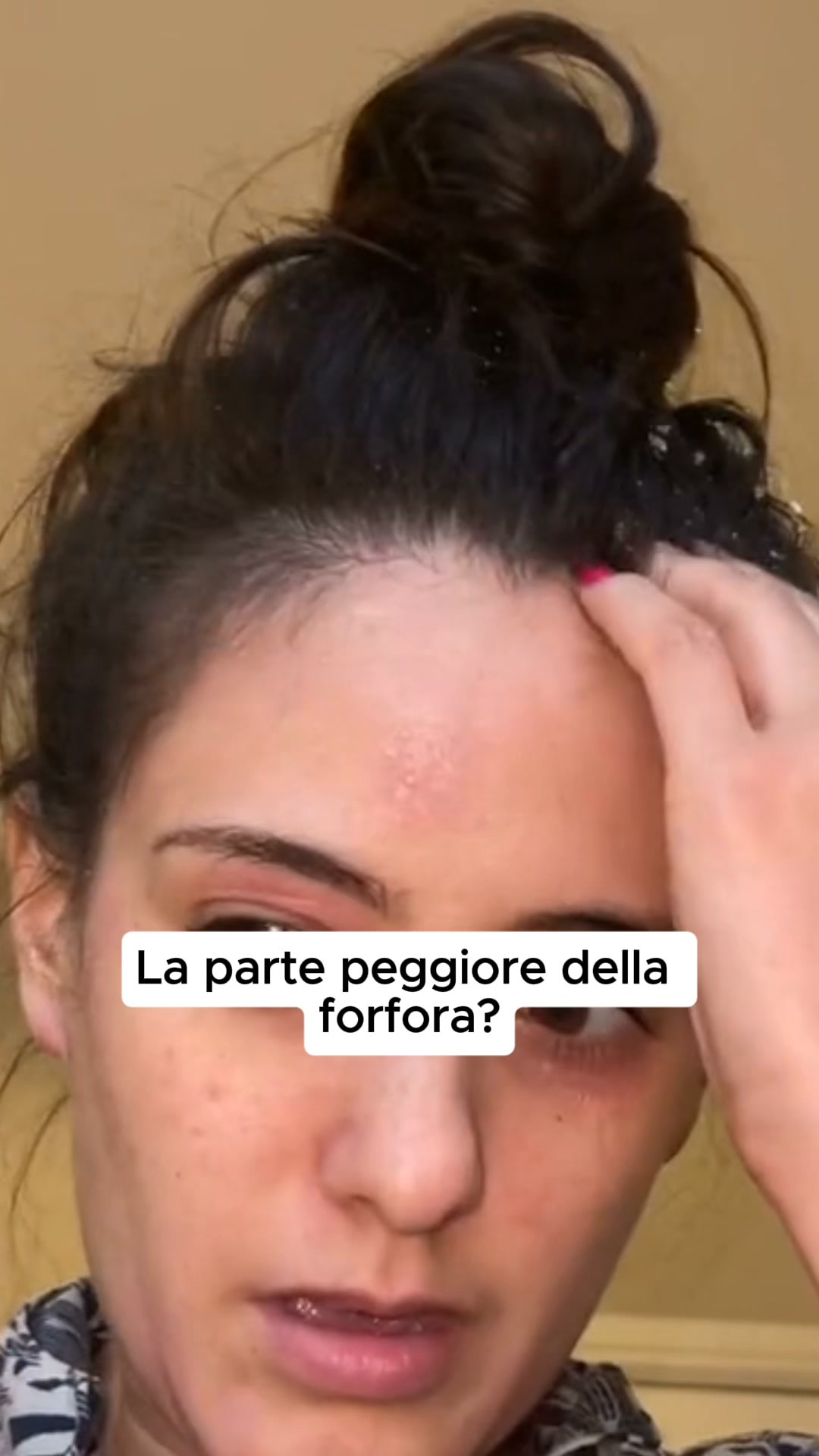 Non è pelle secca. È accumulo
