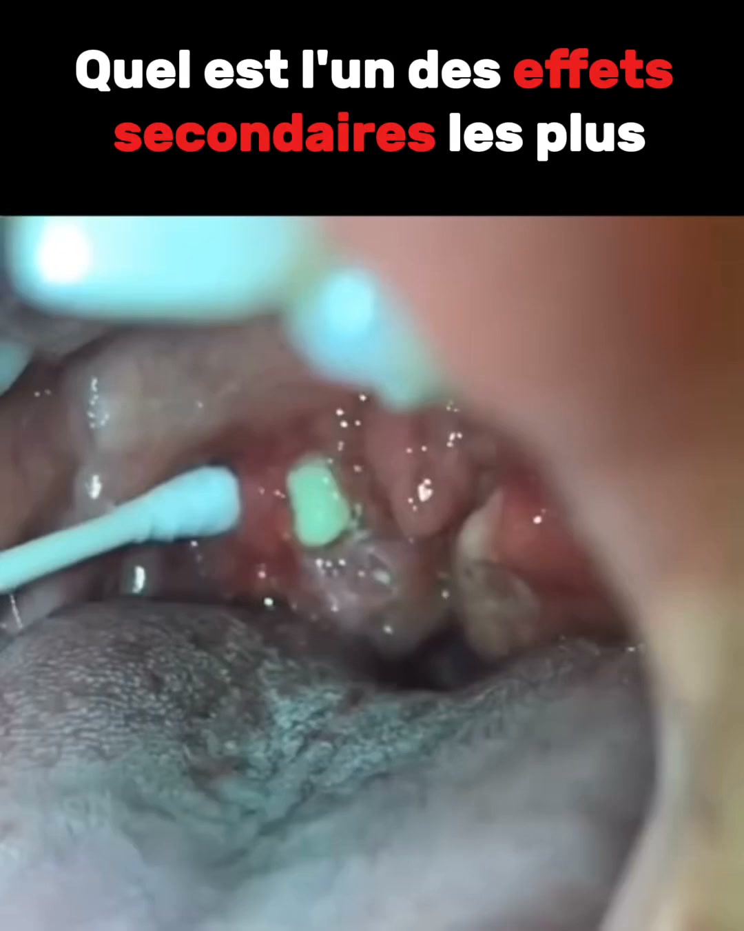 Ronflements : et si tu dormais enfin mieux ?