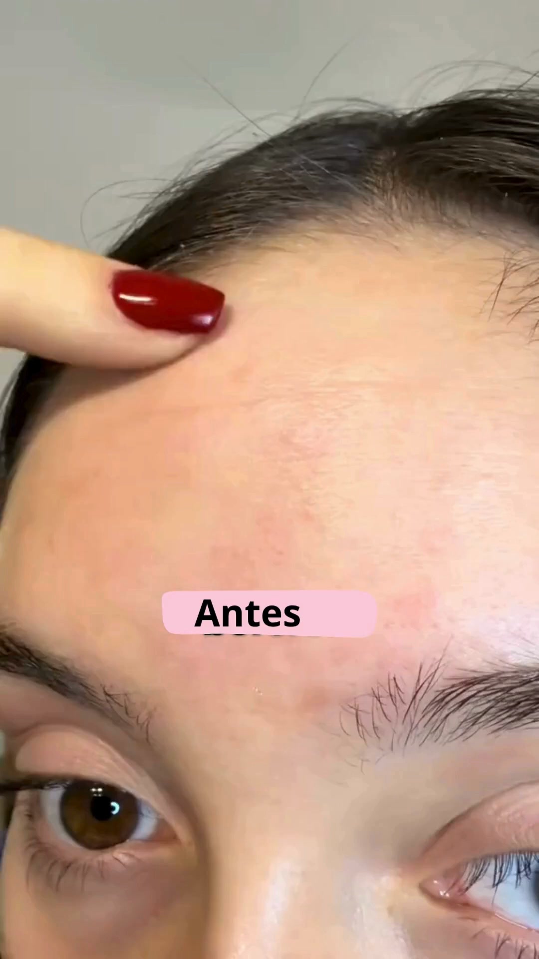 ¿Retinol o Retinal? ¿Por qué elegir uno cuando puedes tener los dos?