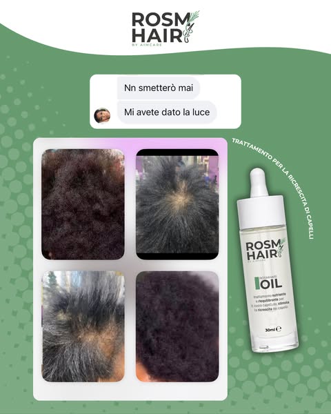 Rosmhair Oil trattamento per il cuoio capelluto