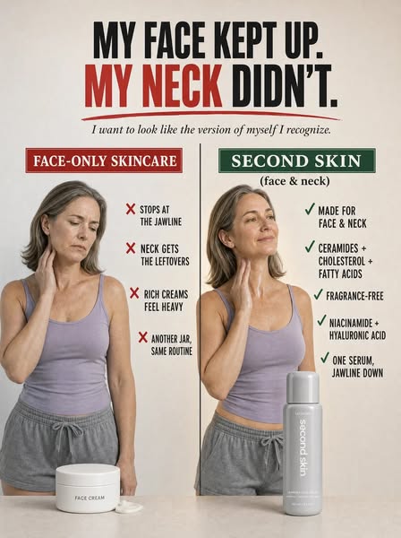 Your face kept up. Your neck didn't.