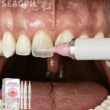 Cavity Repair √FDA-Recognized 10% Nano-Hydroxyapatite (NH-10) |Delivery within 2-4 working days | Full refund guarantee