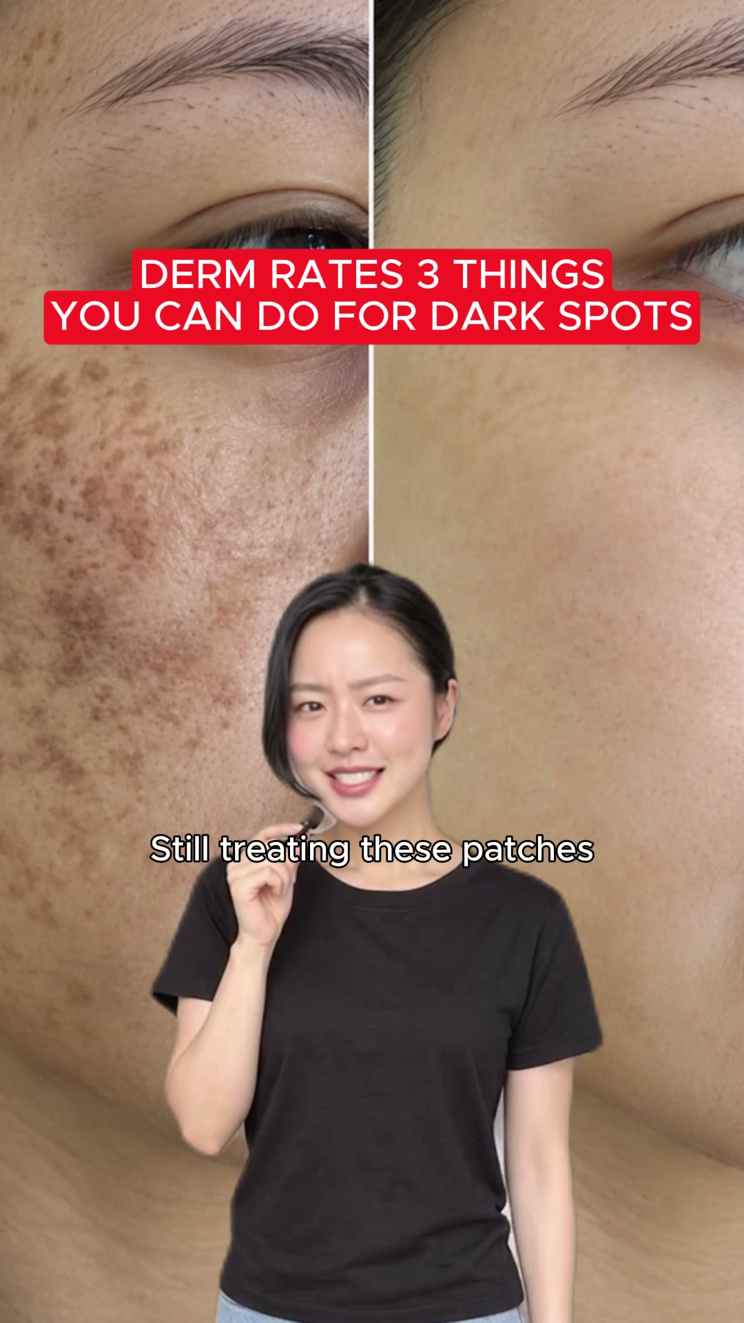Triple-Active Complex for Dark Spots