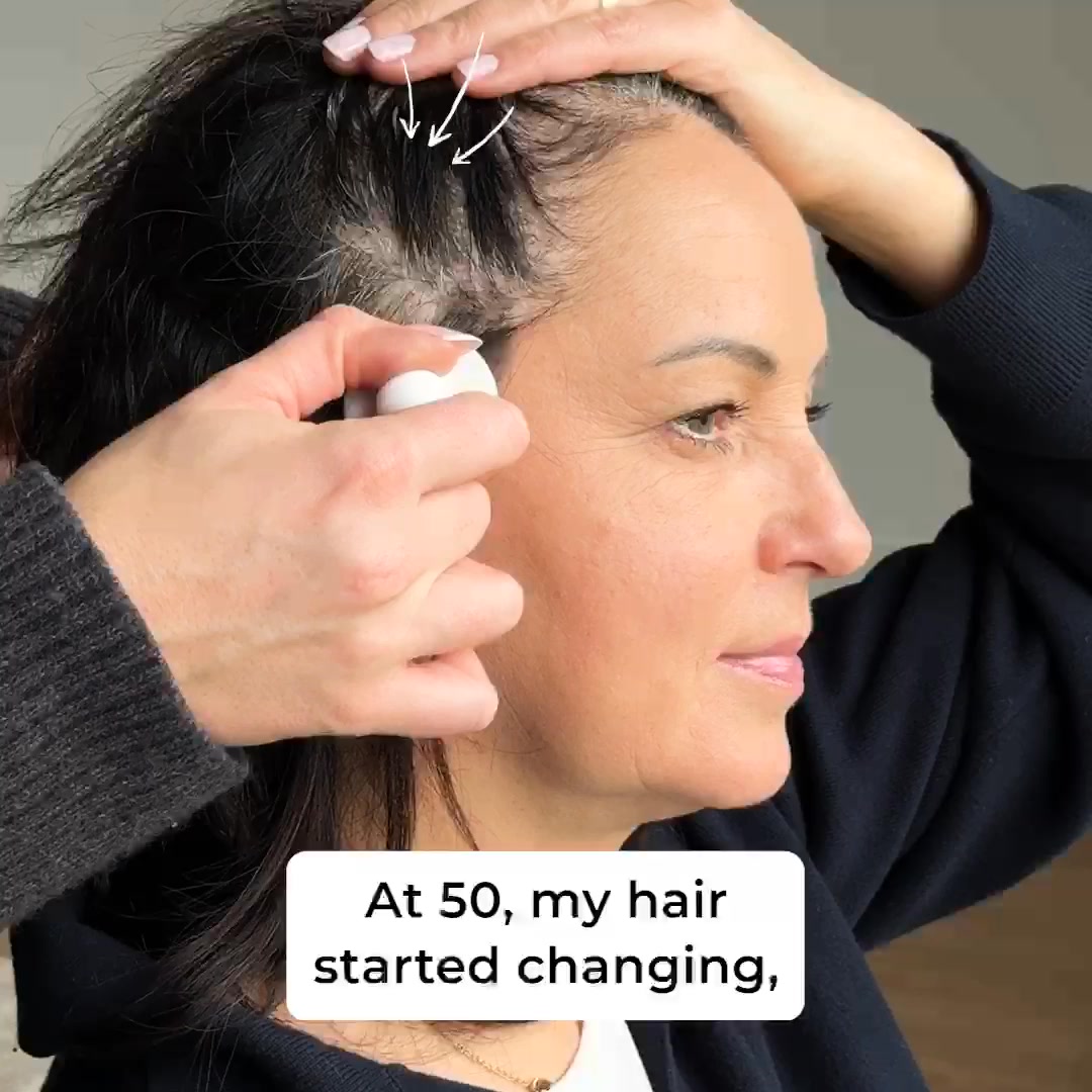 Hairline Miracle for Women Over 40