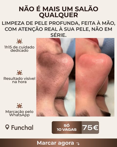 Veja o que uma sessão faz pela sua pele