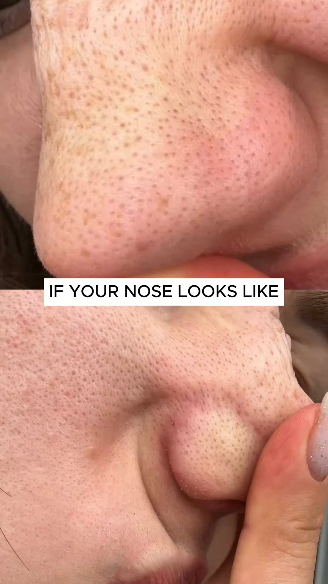 Clear Nose Overnight