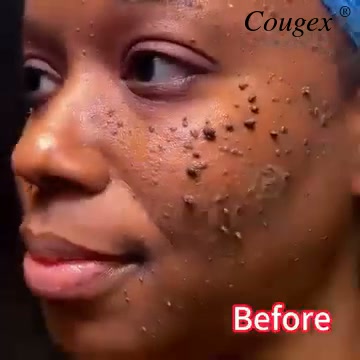 Targeted Cooling. Smoother-Looking Skin.