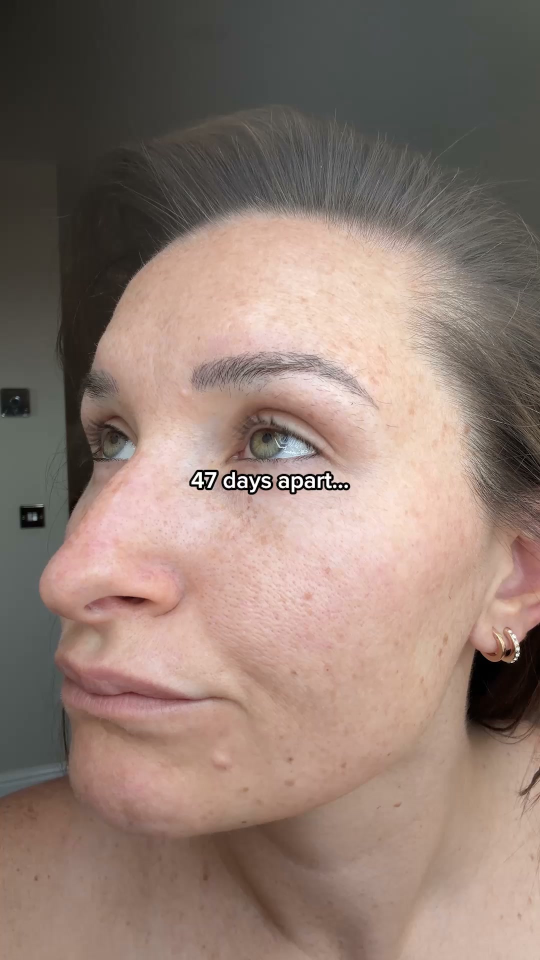 A skin treatment that actually works