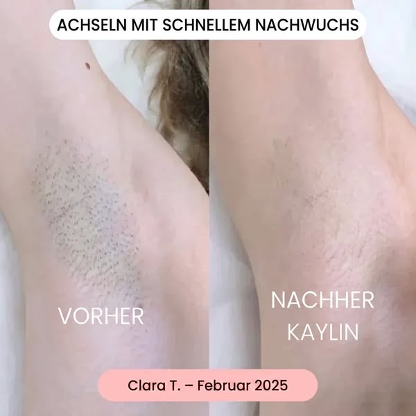 Eine hautschonende Rasur