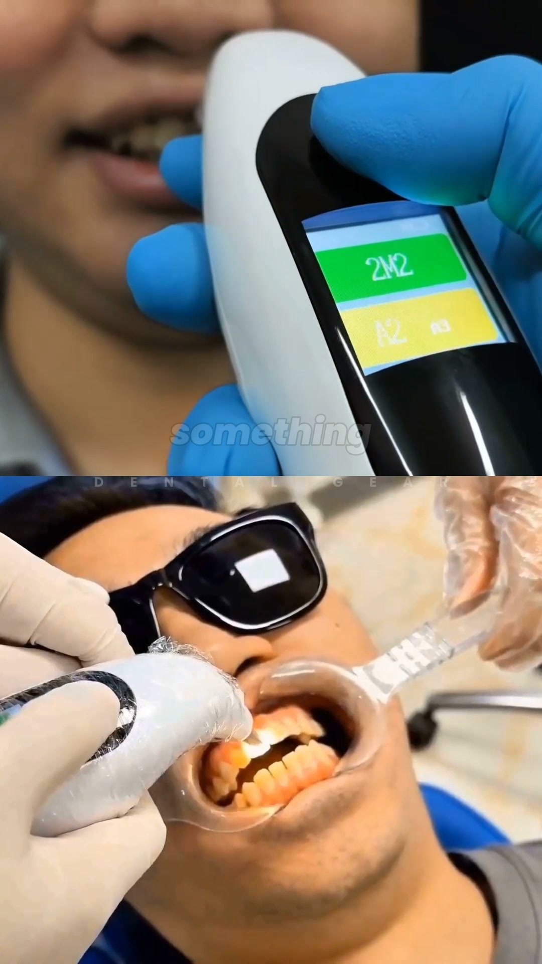 Professional VITA Compatible Tooth Shade Guide