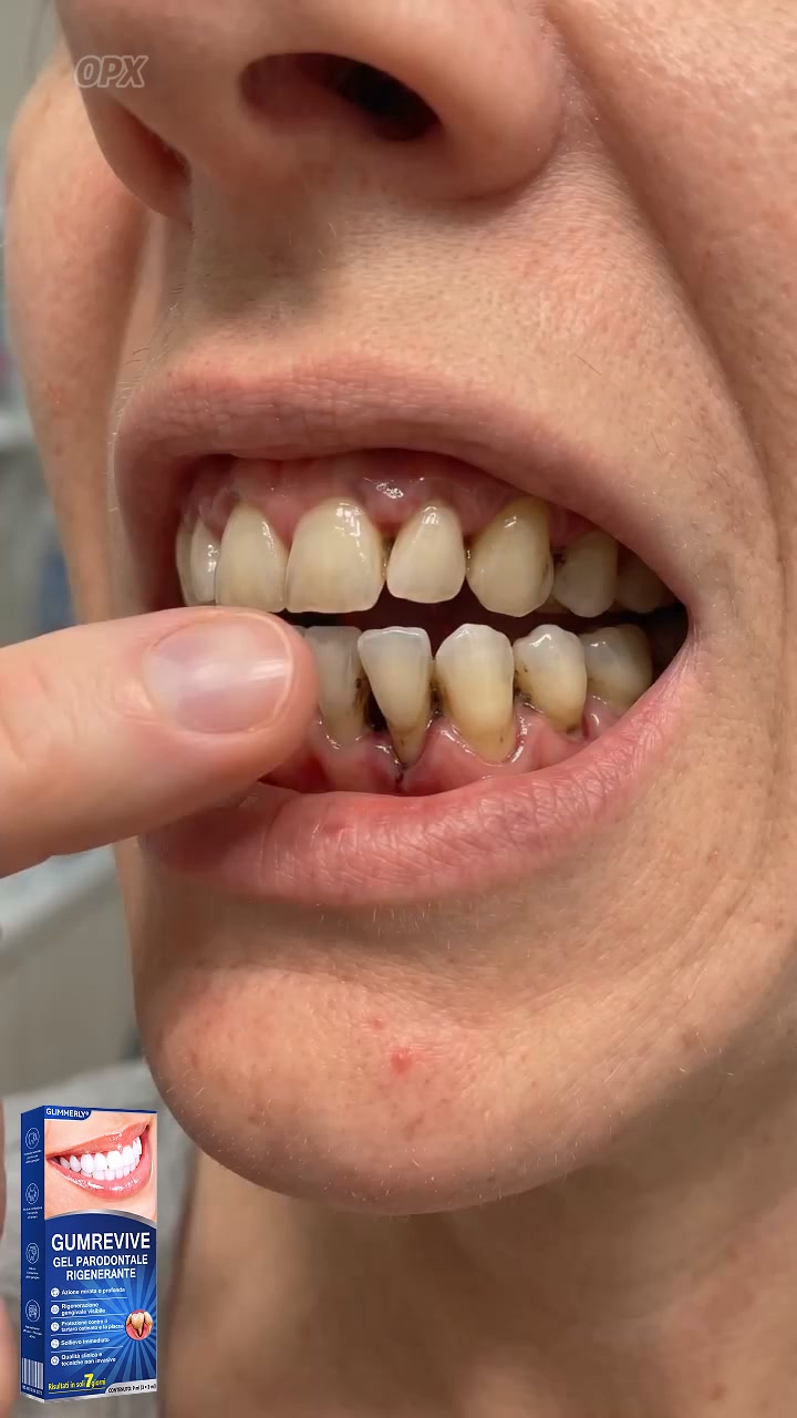 Disponibile in tutta Italia | Formula sviluppata per la cura gengivale mirata | Cura orale di livello professionale | Garanzia di rim