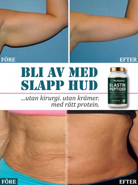 Forskare Hittade Proteinet Som Strammar Lös Hud