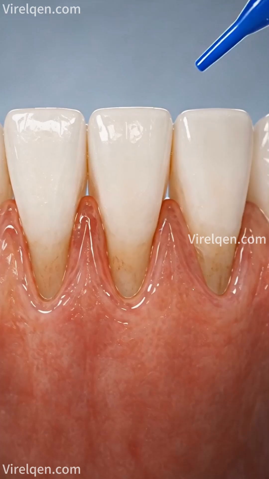 Gum Protect Repair Gel