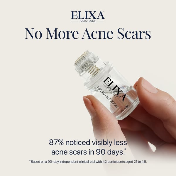 Get Rid of Acne Scars