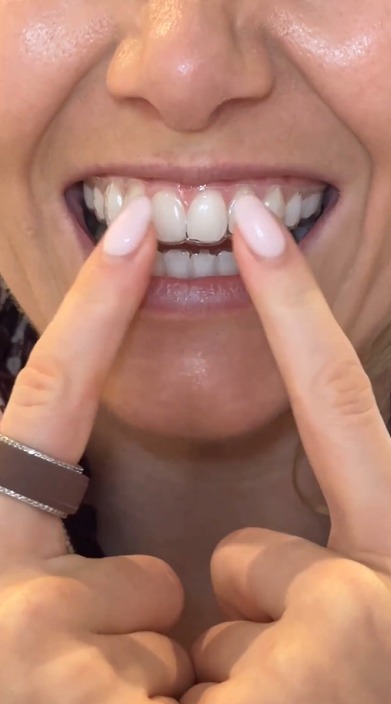 Whiter Teeth In 30 Days Or Your Money Back