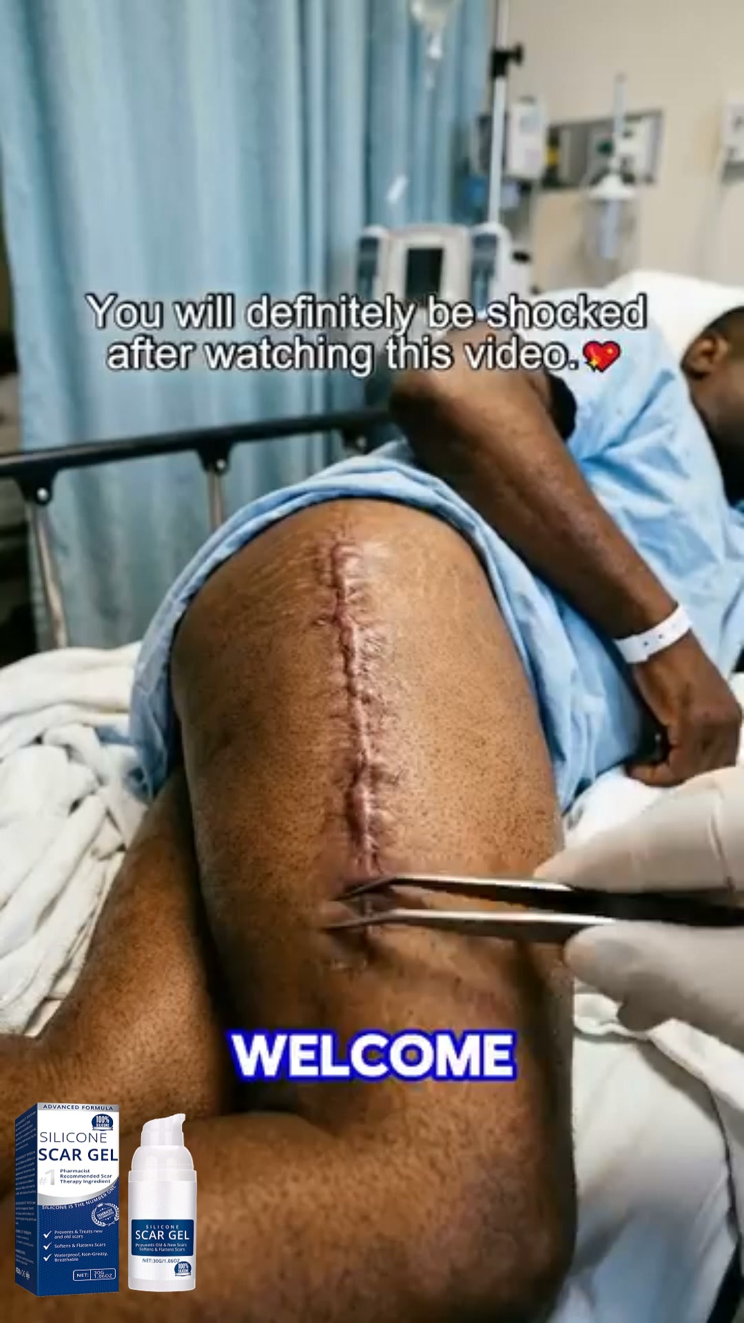 Care for New & Old Scars With Ease