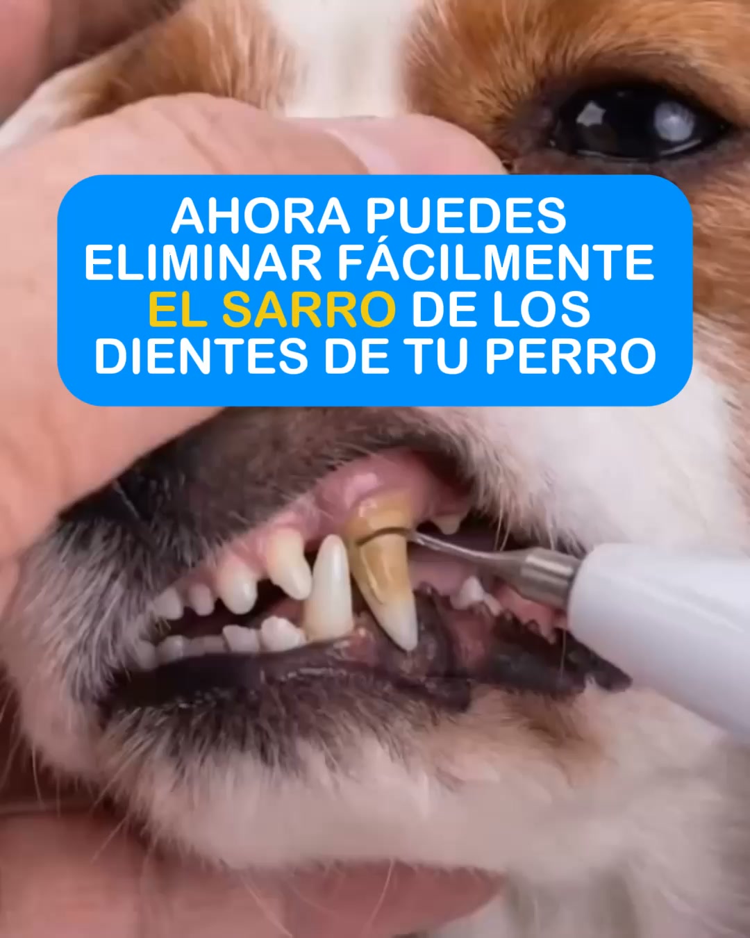 Envío Gratis 24/48h - Pago Contrareembolso