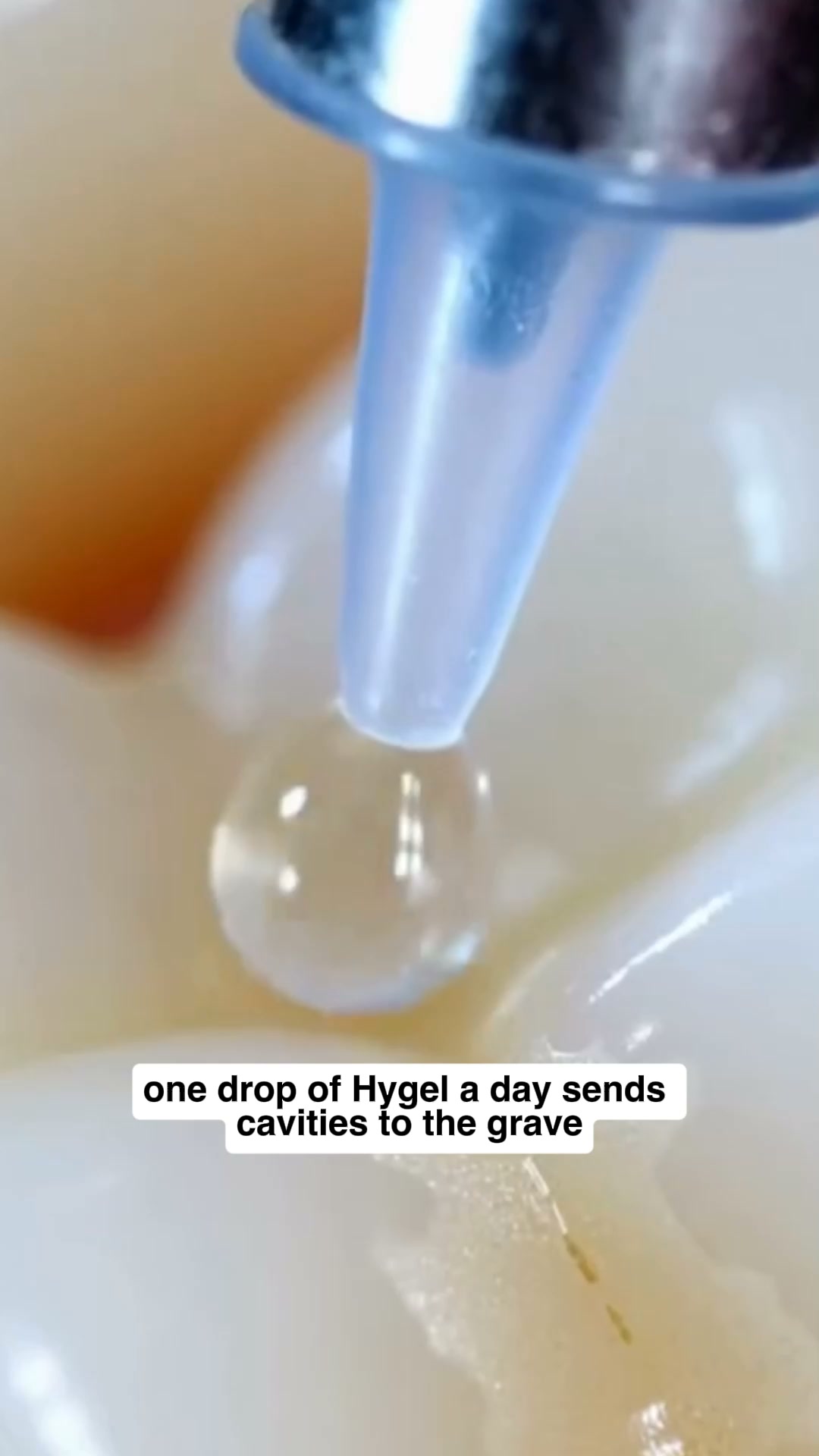 Get HYGEL — Up to 44% OFF