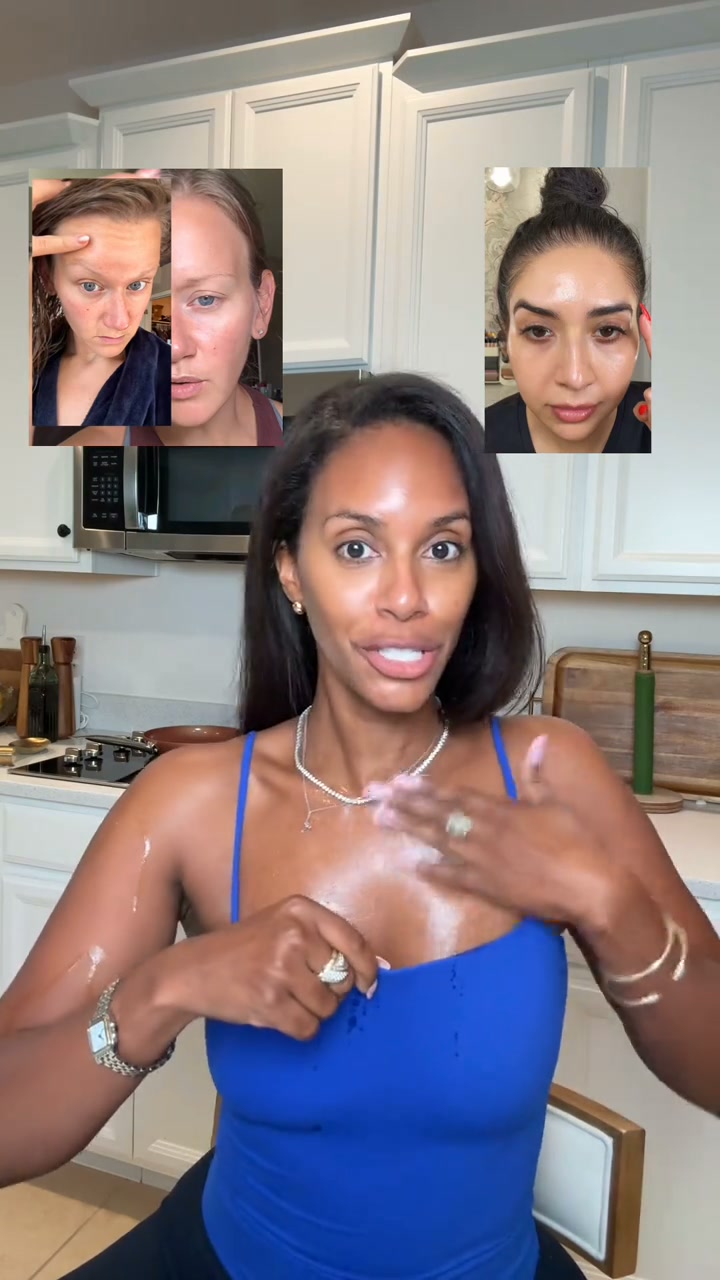 Smooth Forehead Wrinkles Without Needles
