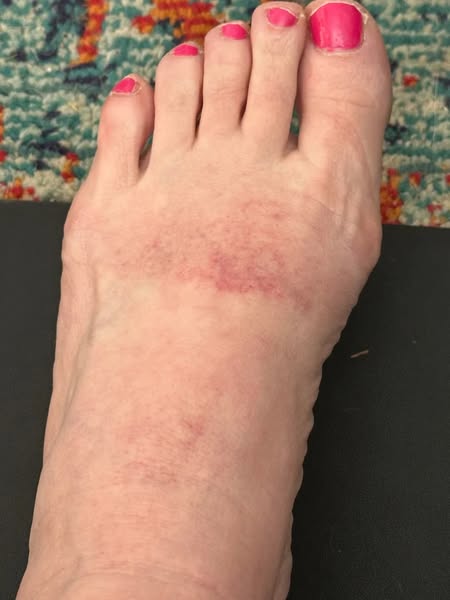 How I discovered my 'permanent' nerve damage wasn't permanent…