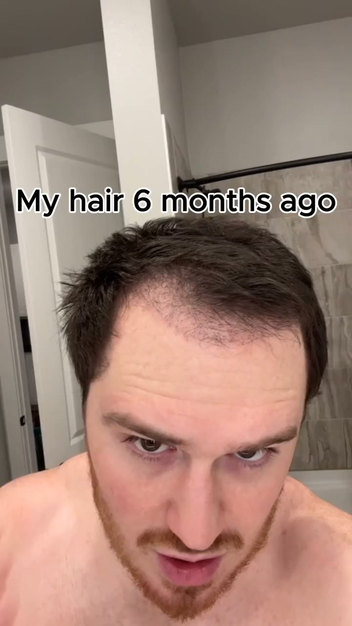 Restore Your Hair