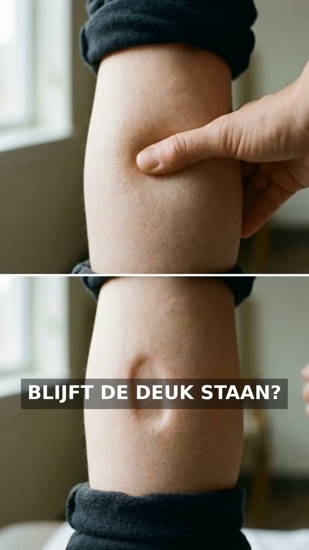 Het ligt niet aan je levensstijl - het begint bij je lymfestelsel.