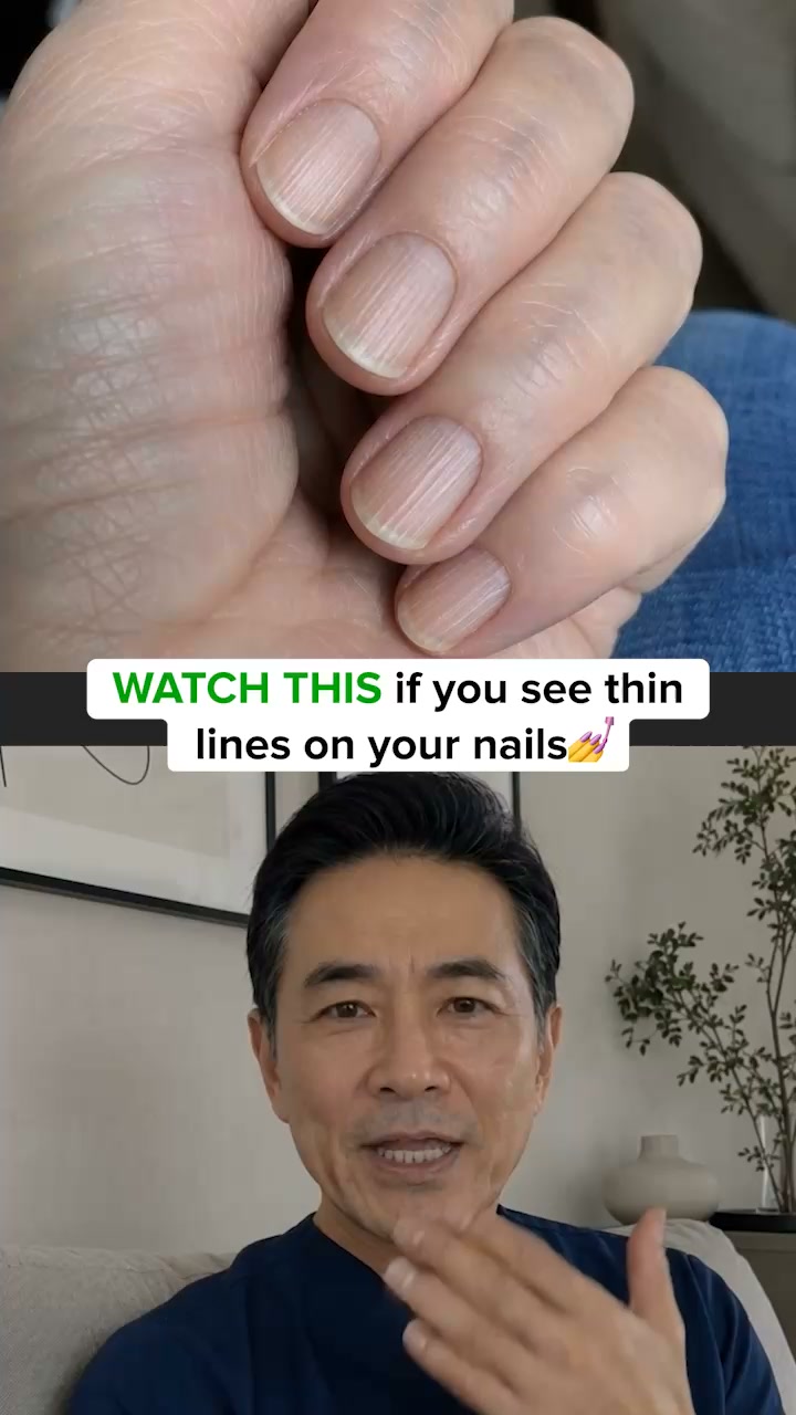 This helped me grow smooth nails again