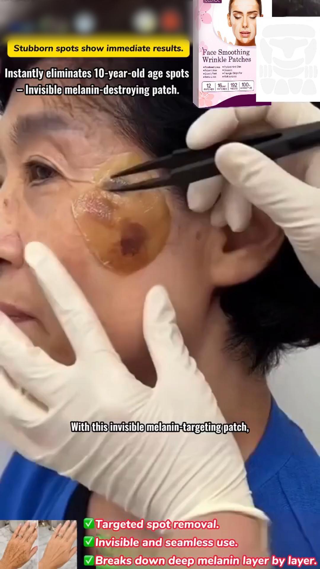 Instantly Fade 10-Year Old Dark Spots | Invisible Melanin Dissolving Patches