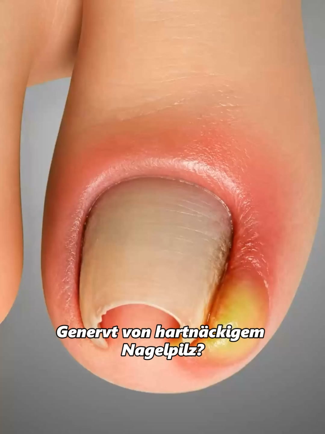 Gesunde Nägel von der Wurzel an