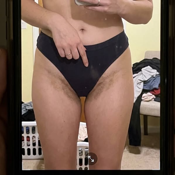 When Dark Spots Won’t Budge