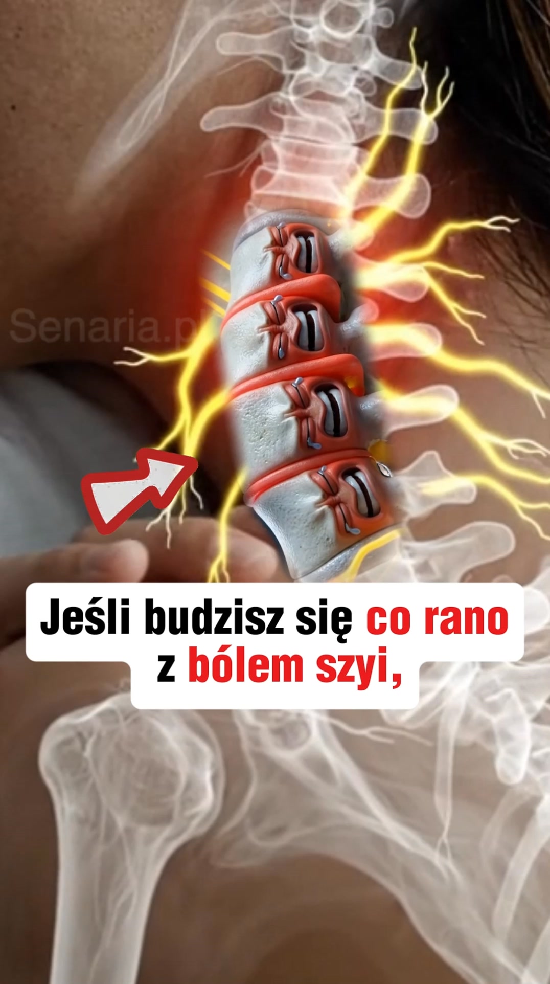Sen bez bólu szyi