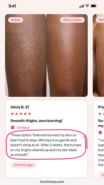 Smoother skin in as little as 14 days