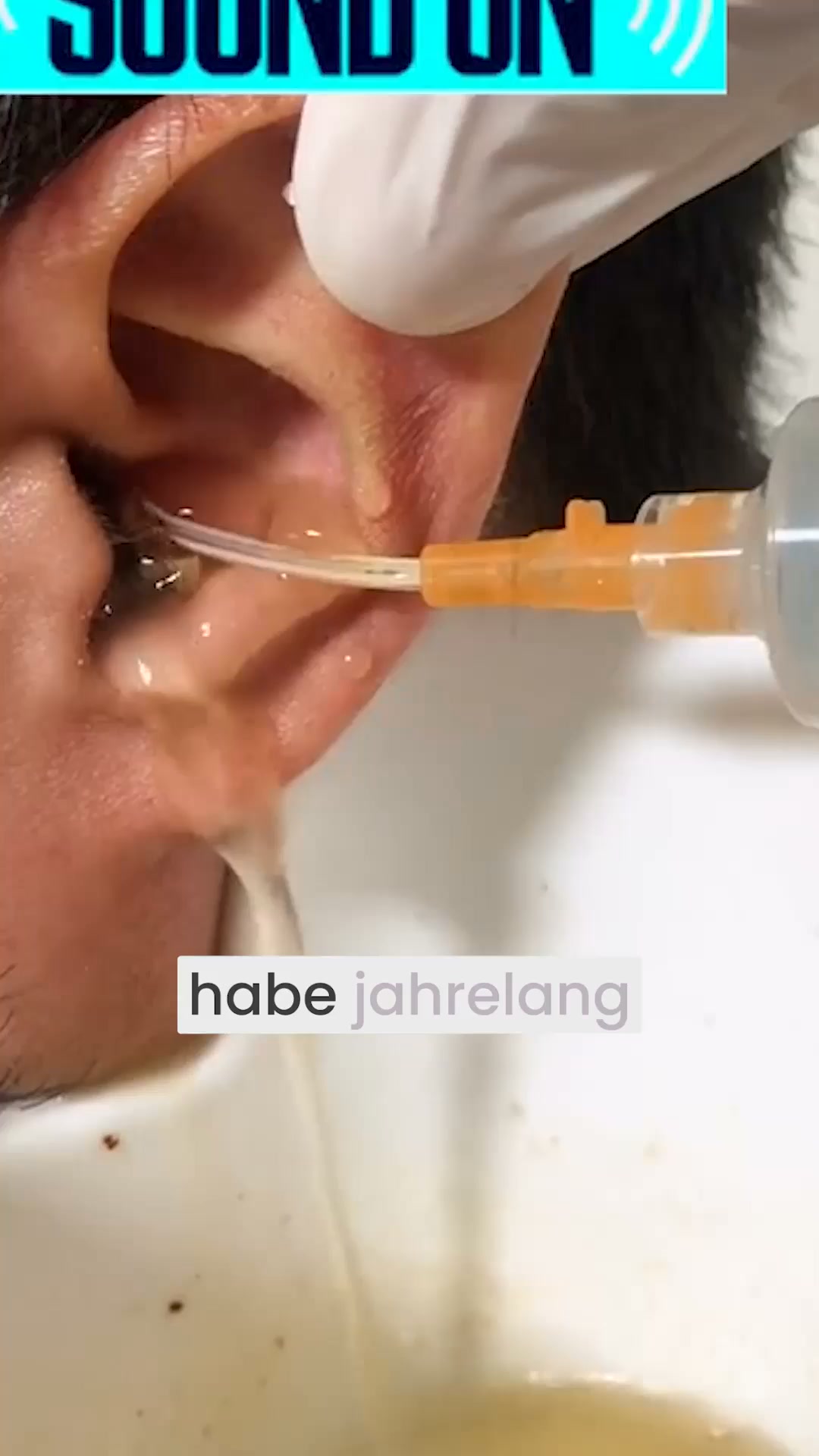 Endlich saubere & freie Ohren