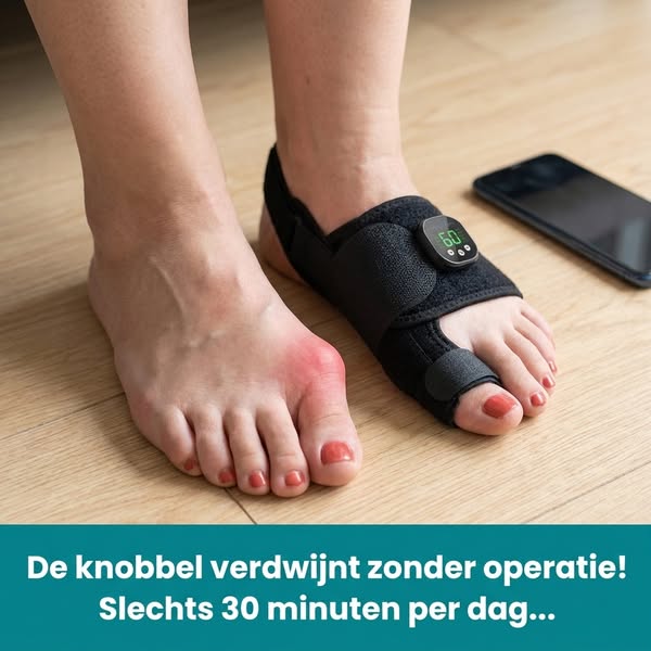Dit 30-Minuten Geheim Stopt Knobbelpijn (Geen Operatie Nodig)
