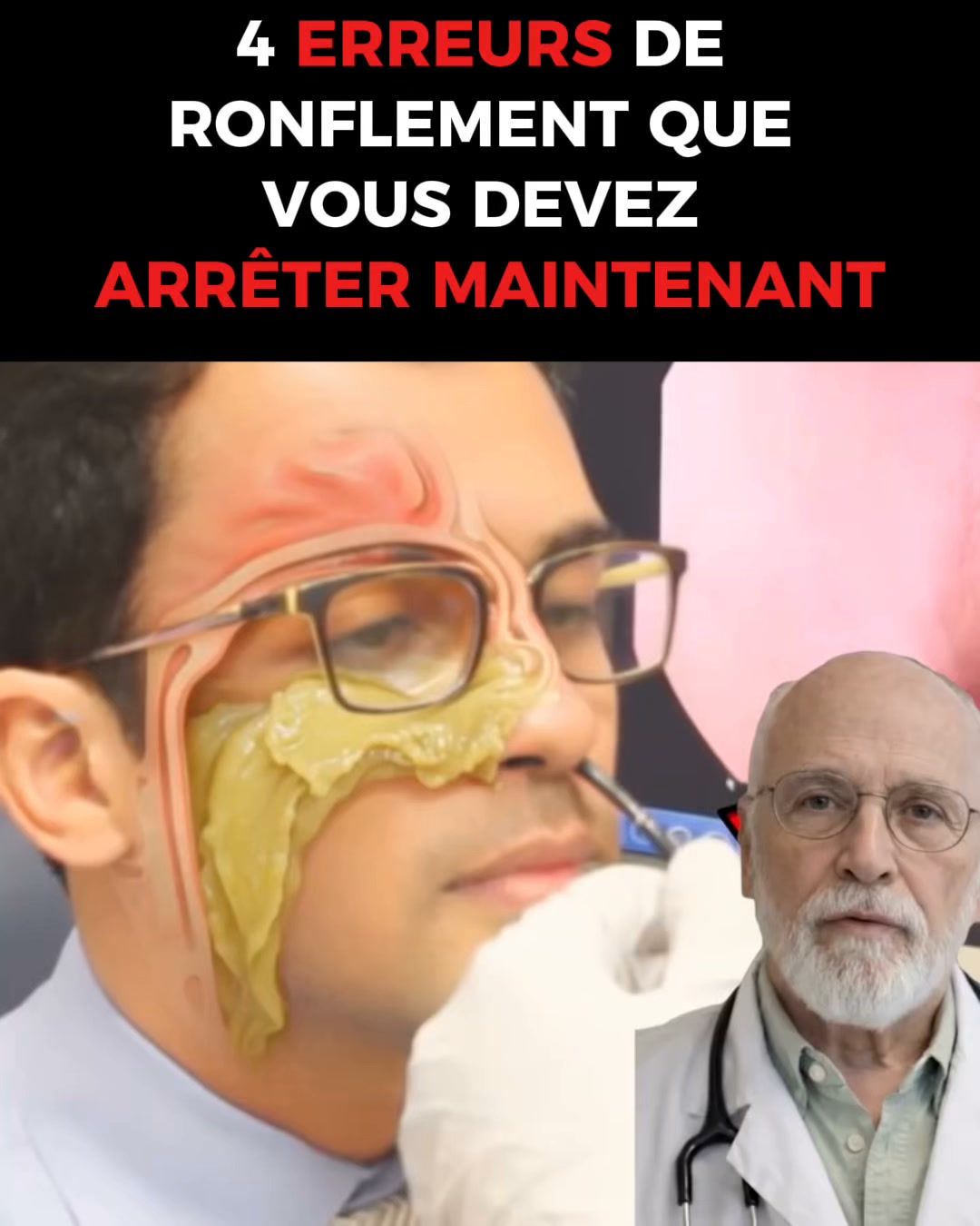 Ronflements : et si vous dormiez enfin mieux ?