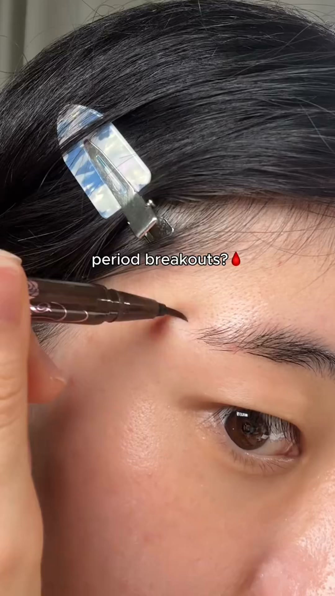Calmer, Clearer-Looking Skin