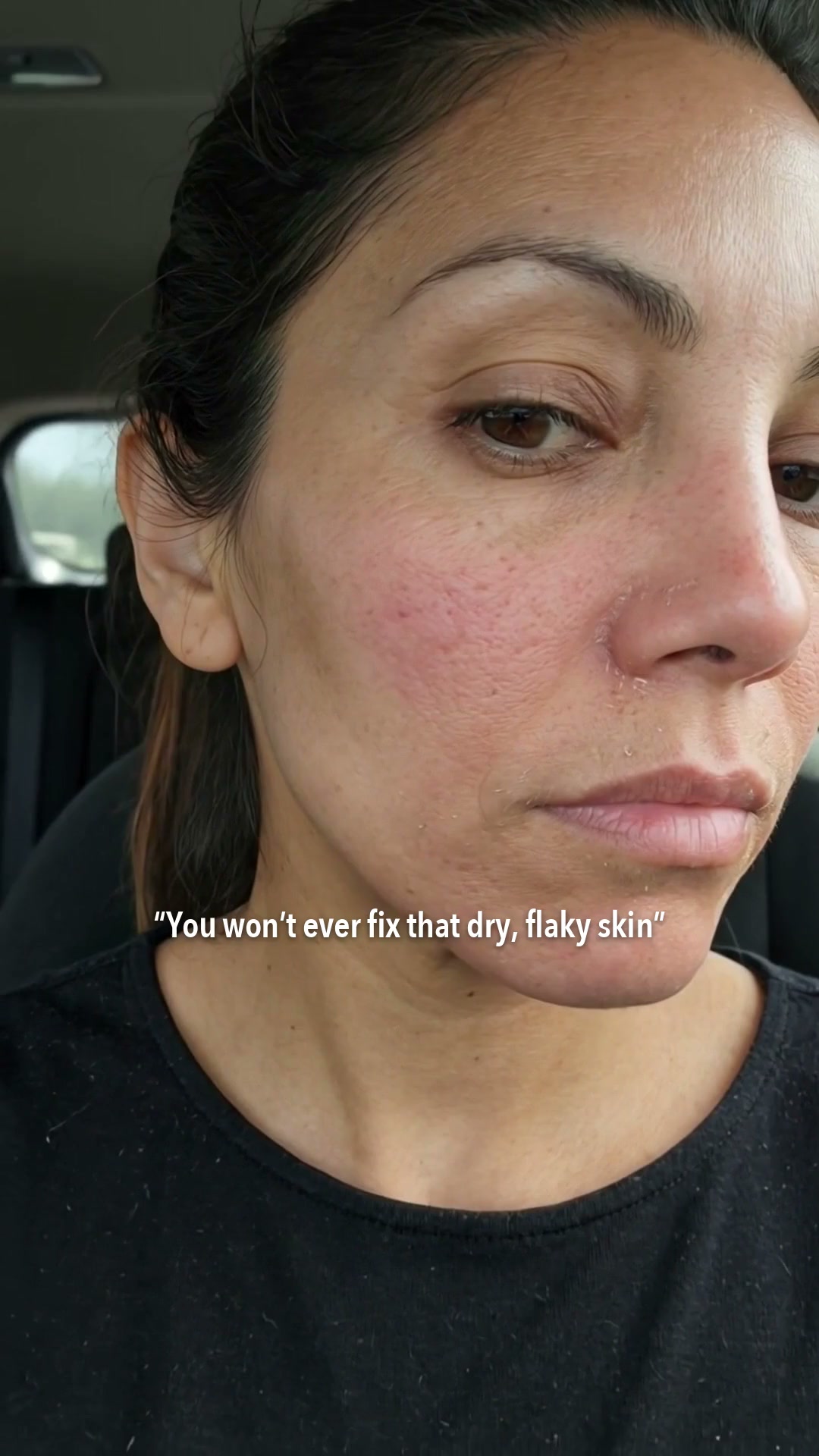 [Amazon's Pick] Hyaluronic Acid Hydrating & Plump Glow Serum