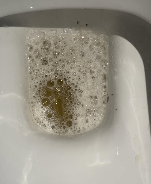 After menopause, bladder leakage isn't a muscle problem.