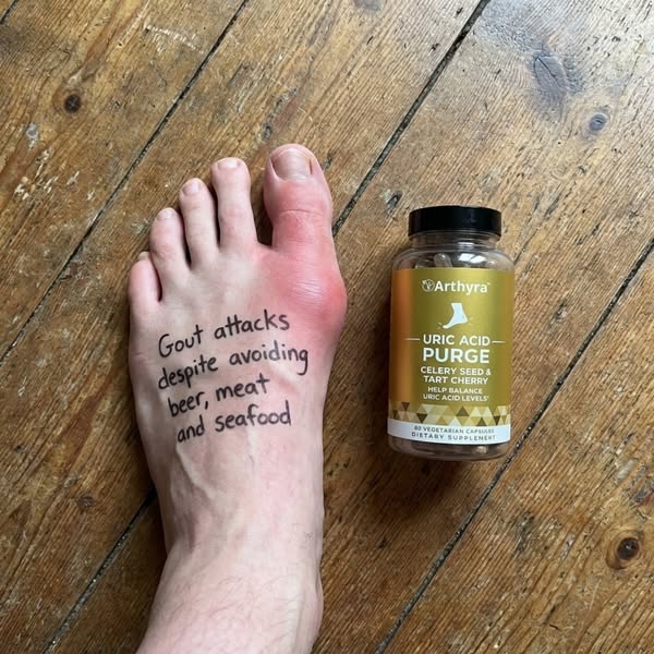 Allopurinol can help stop new uric acid being made — but it does nothing for the crystals already lodged in your joints.